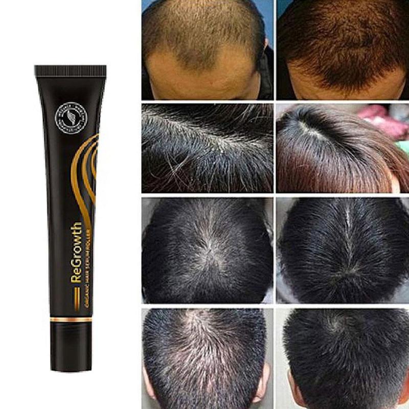 GinsengRegrow™ Hair Care Serum Roller MayorAccess